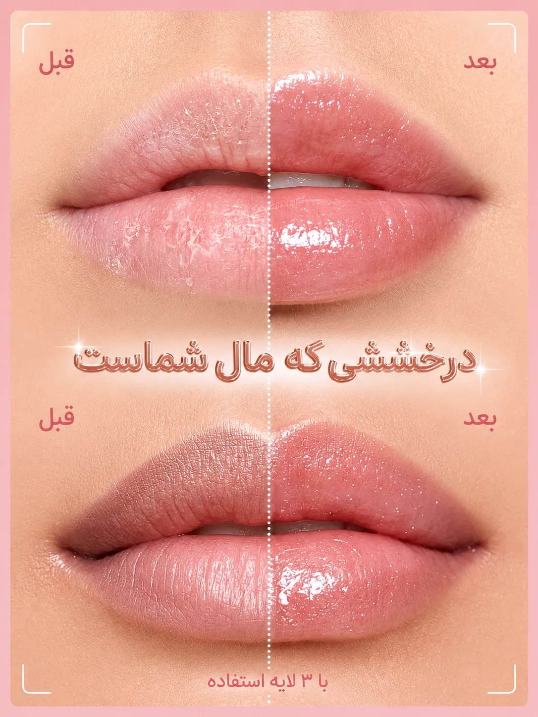 نمای قبل و بعد لب‌ها با لیپ گلاس آمپولی شیگلم؛ لب‌ها در بخش بعدی براق‌تر و صورتی‌تر دیده می‌شوند